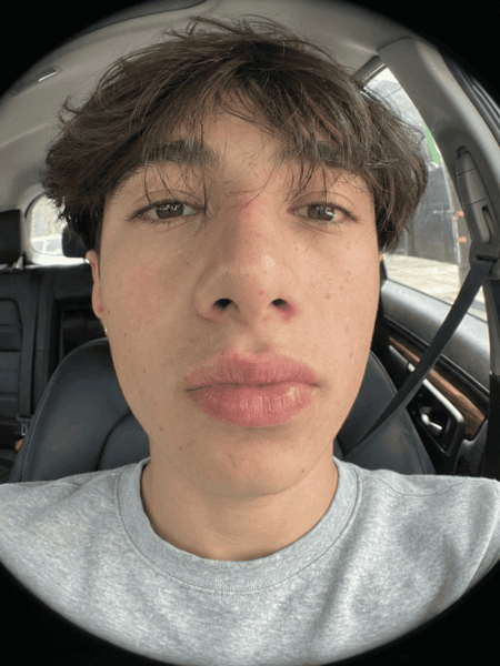 Fish-Eye Lens preset preview